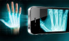 x-ray technology for smartphones iPhone