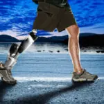New Prosthetics Technologies for Animals and Humans