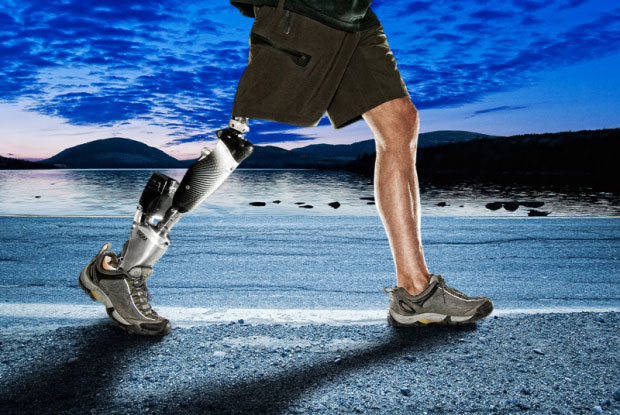 Prosthetics Technologies for animals and humans