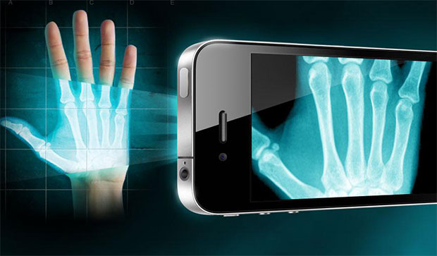 x-ray technology for smartphones iPhone